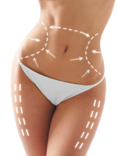 cryolipolysis